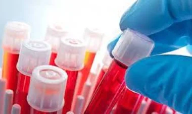 Söyüdlü sakinlərinin tibbi müayinələrinin nəticələri