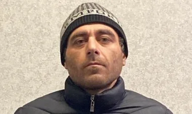 Stomatoloji kabinetdən 9 qızıl diş oğurlandı