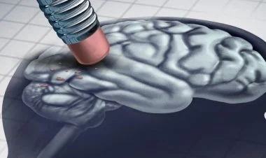 Alzheimer xəstəliyi orqan nəqli ilə də yayıla bilər