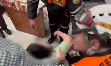 Çörək sexində qadının əli xəmirqarışdıran qazanda qaldı