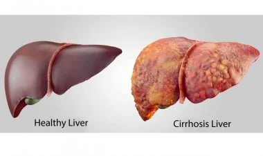 Qaraciyər xəstəliklərinin müalicəsinə kömək edən muncuqlar