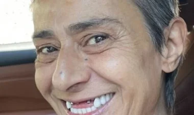 Türkiyəli müğənni Yıldız Tilbe dişsiz şəklini paylaşdı
