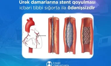 Ürək damarlarına stent qoyulması ödənişsizdir