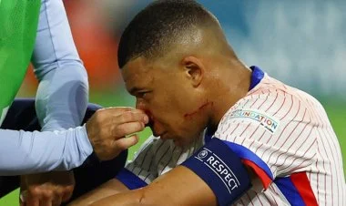 Avro-2024: Mbappenin burnu sınıb