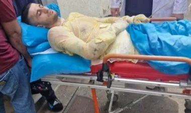 Qız qaçıran qazi özünü yandırdı