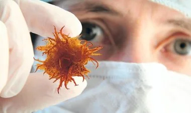 Alman kimyaçıları xərçəng xəstəliyinə çarə tapıblar