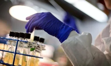 Ağız bakteriyaları ilə xərçəng arasında əlaqə