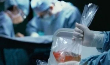 Azərbaycanda orqanlarını bağışlamaq istəyənlərin sayı artıb