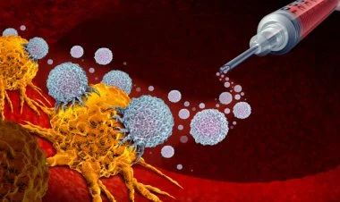 Britaniyalı alimlər xərçəngə qarşı peyvənd hazırlayırlar