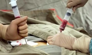 Sümük iliyi köçürməsi tibbi sığorta ilə mümkün olacaq