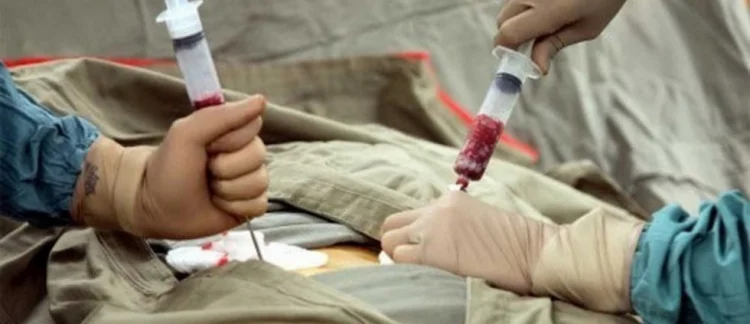 Sümük iliyi köçürməsi tibbi sığorta ilə mümkün olacaq